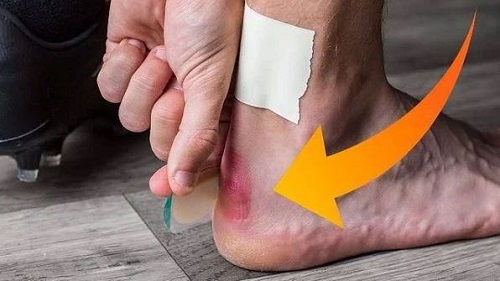 đi giày bị cứng